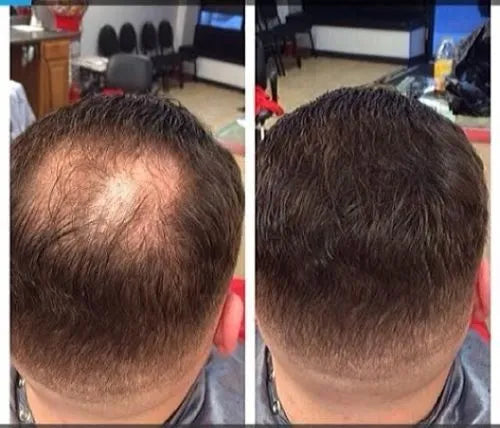 "Recupera tu Cabello y tu Confianza: La Máscara Capilar que Rellena, Fortalece y Transforma"