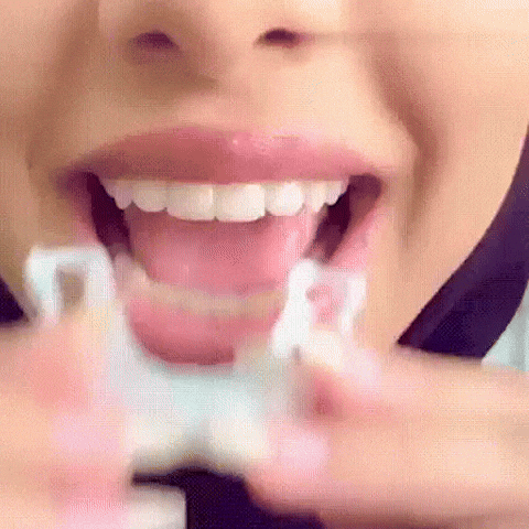 ¡Sonríe sin miedo! Transforma tu sonrisa en segundos con Snap-On Smile