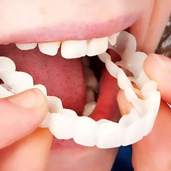 ¡Sonríe sin miedo! Transforma tu sonrisa en segundos con Snap-On Smile